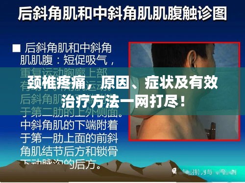 颈椎疼痛，原因、症状及有效治疗方法一网打尽！